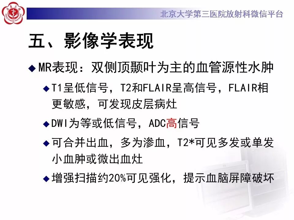 【病例】可逆性后部脑病综合征1例MR