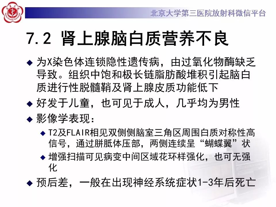 【病例】可逆性后部脑病综合征1例MR