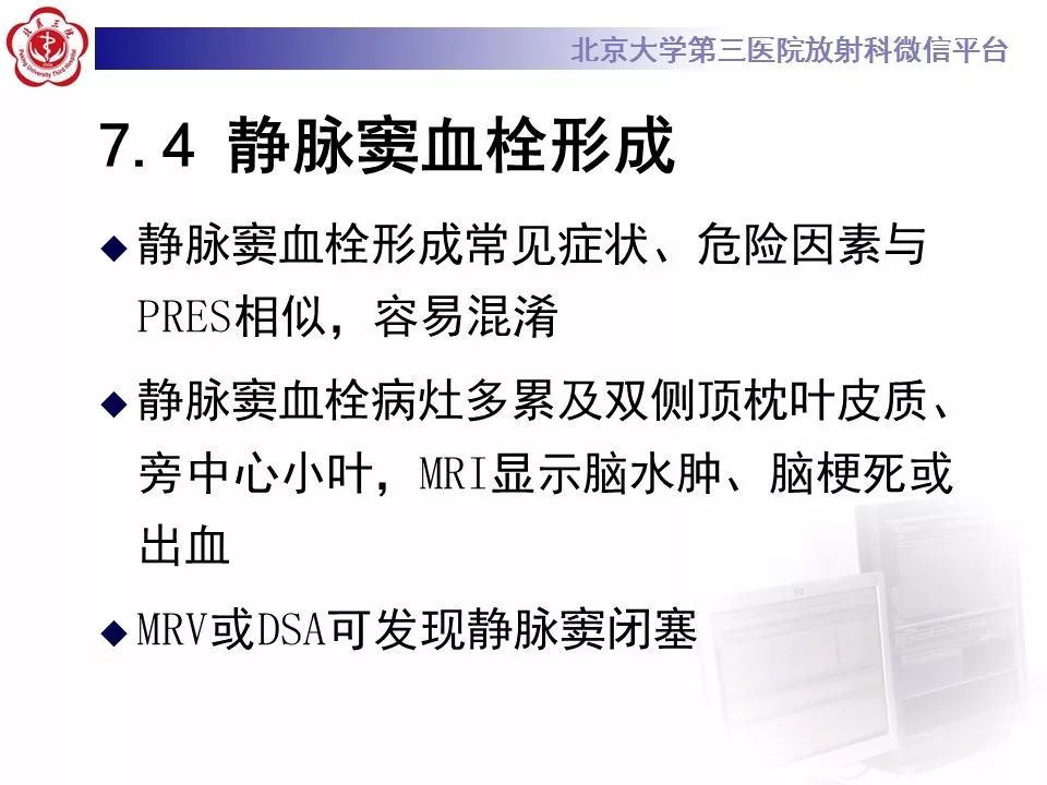 【病例】可逆性后部脑病综合征1例MR