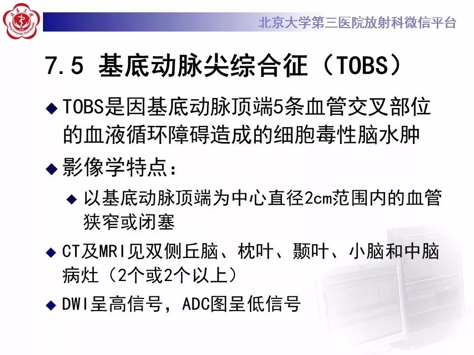 【病例】可逆性后部脑病综合征1例MR