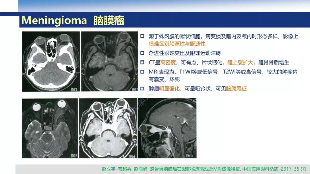 【PPT】颅眶沟通性病变影像诊断
