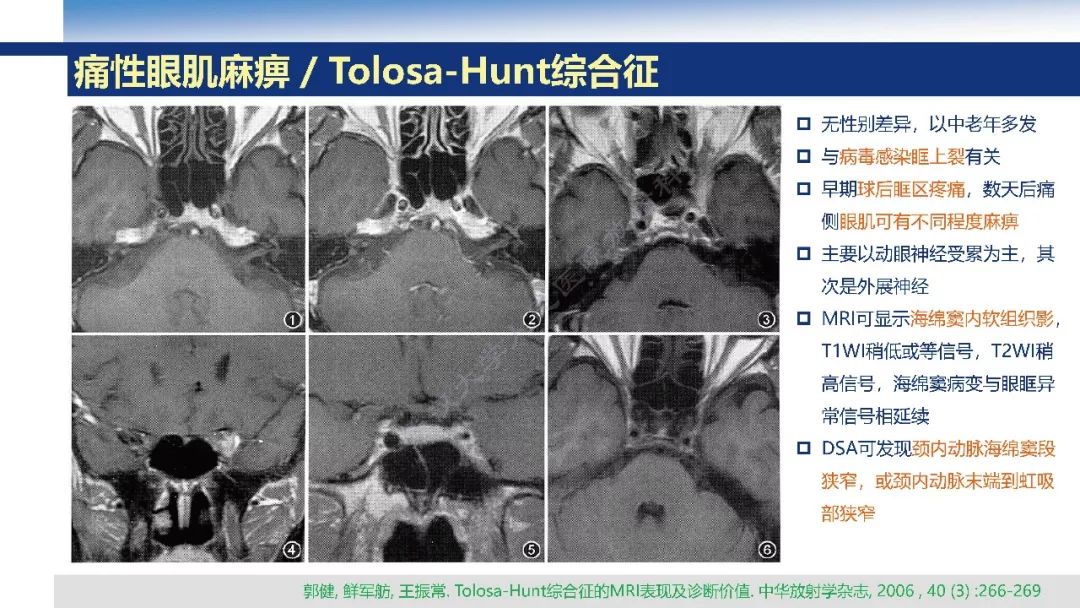 【PPT】颅眶沟通性病变影像诊断