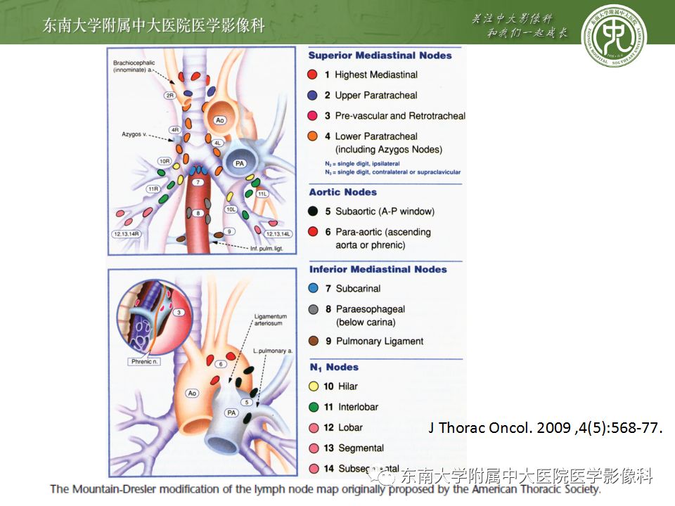 【病例】肺结节病1例CT影像表现