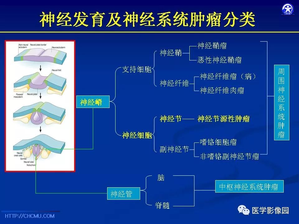 【PPT】儿童腹膜后神经节源性肿瘤的影像诊断