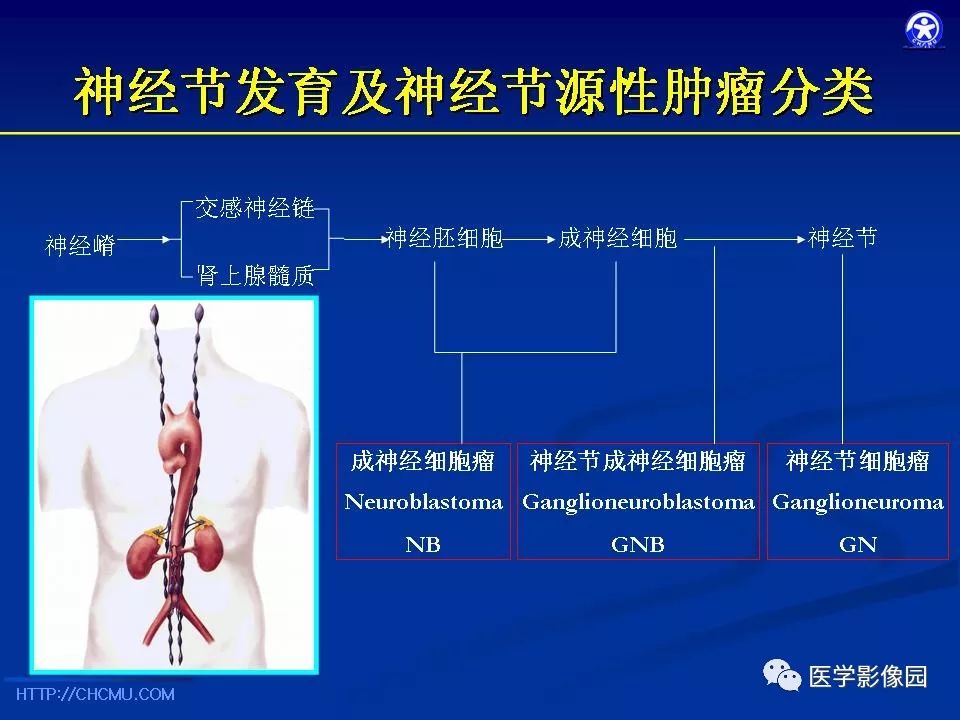 【PPT】儿童腹膜后神经节源性肿瘤的影像诊断