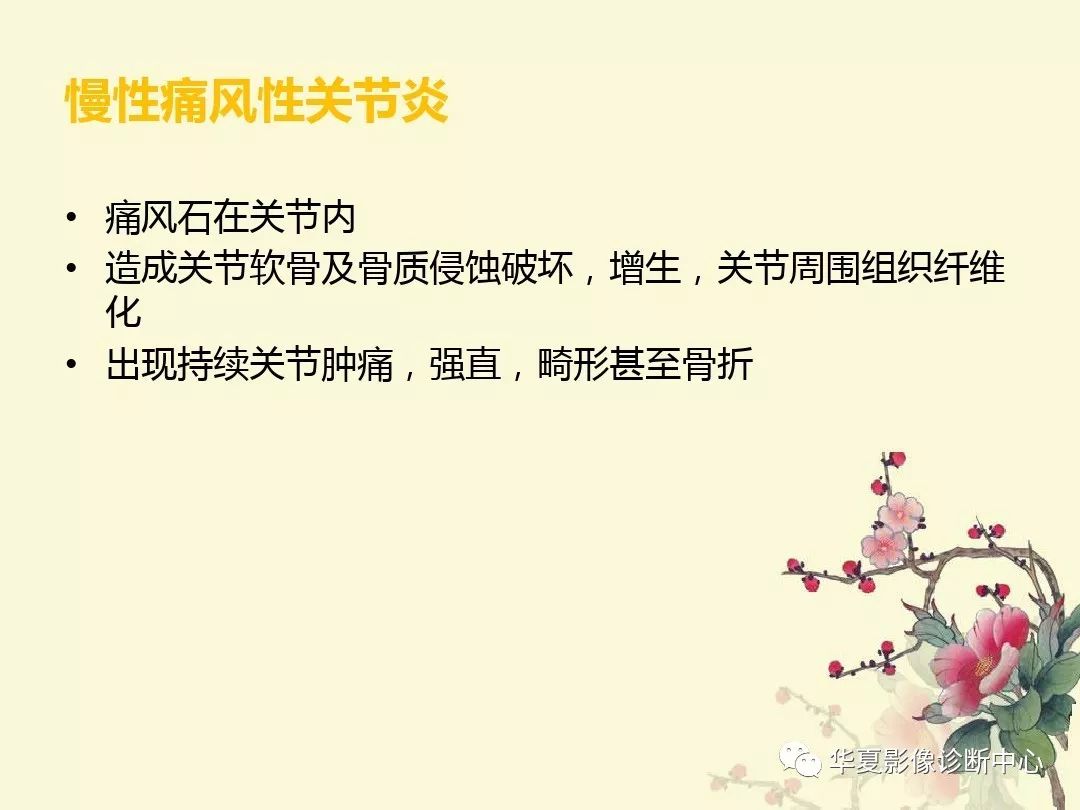 【PPT】痛风性关节炎及假性痛风