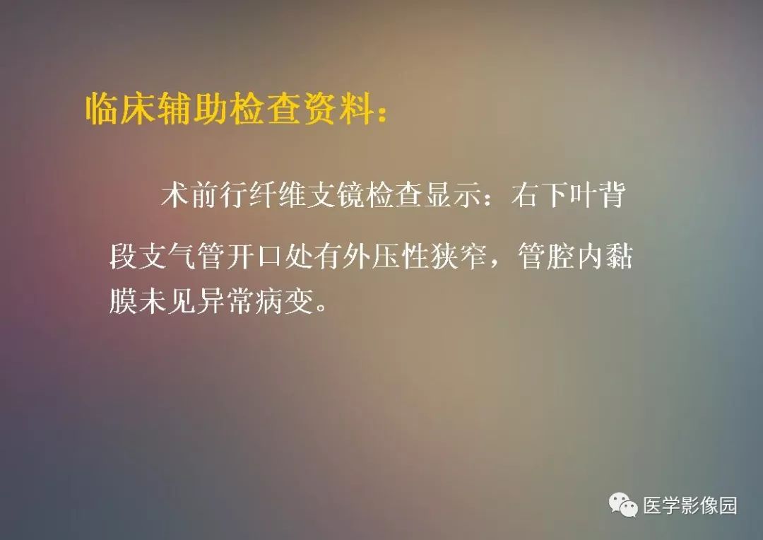 【PPT】右肺门区类圆形肿物的鉴别诊断—病例分析