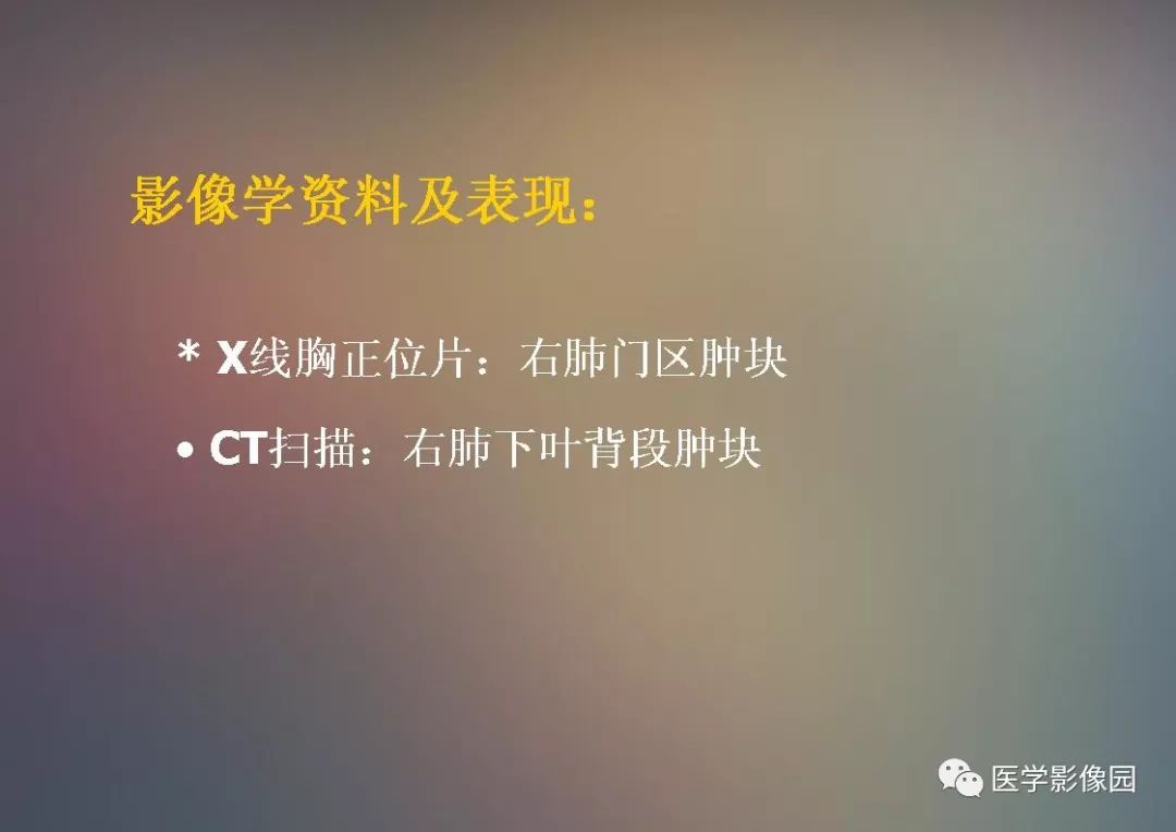 【PPT】右肺门区类圆形肿物的鉴别诊断—病例分析