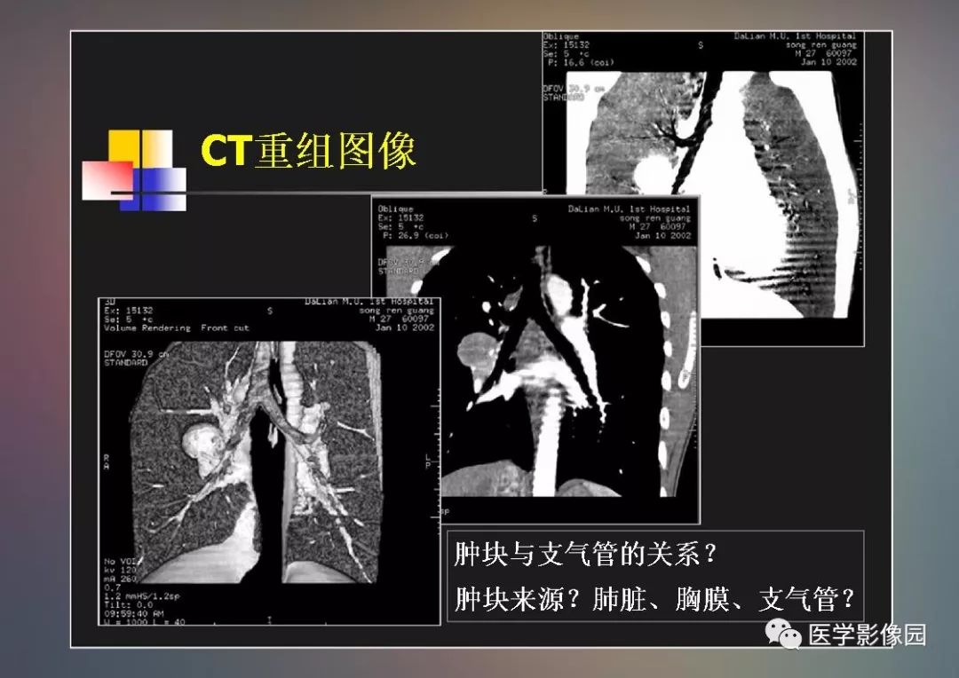 【PPT】右肺门区类圆形肿物的鉴别诊断—病例分析
