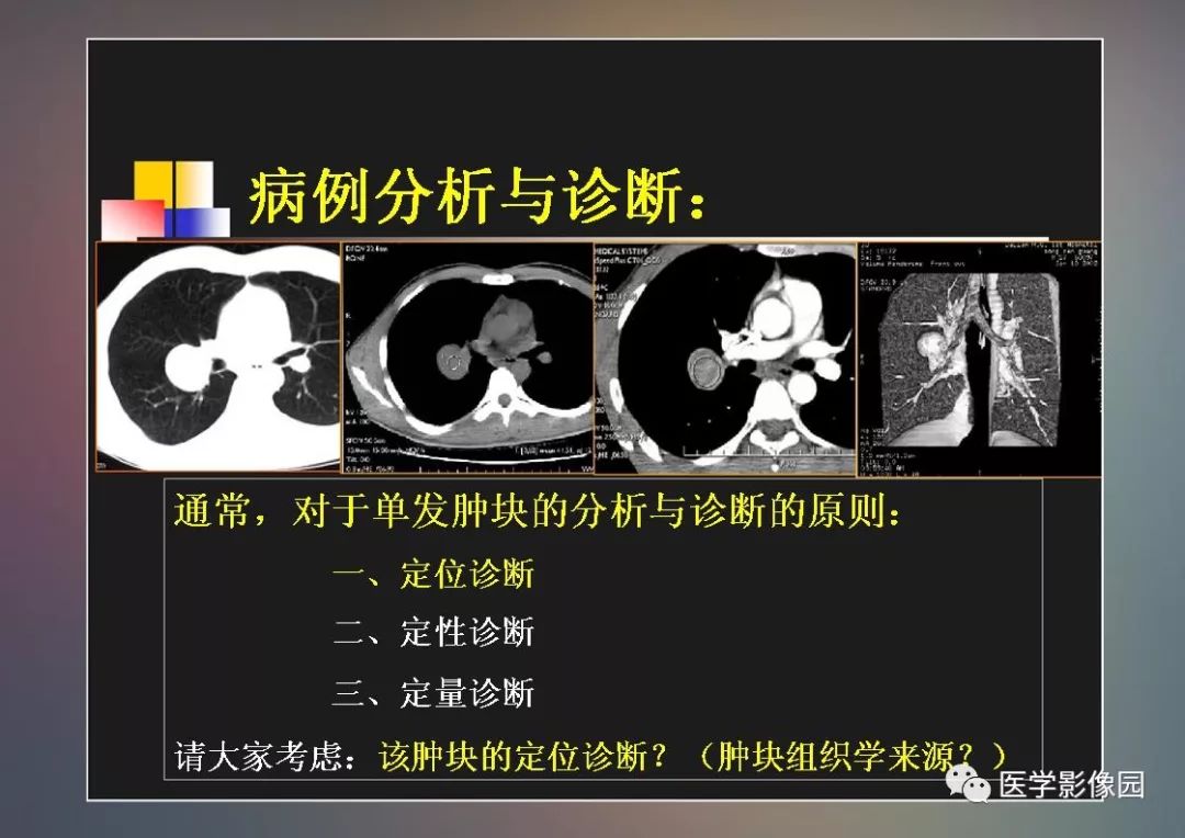 【PPT】右肺门区类圆形肿物的鉴别诊断—病例分析