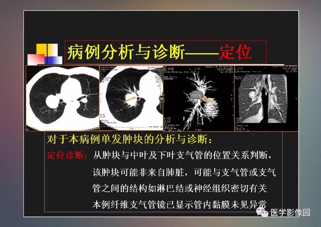 【PPT】右肺门区类圆形肿物的鉴别诊断—病例分析