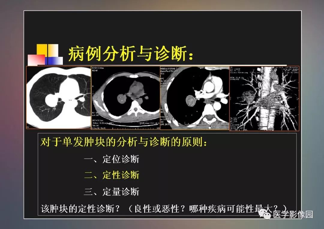 【PPT】右肺门区类圆形肿物的鉴别诊断—病例分析