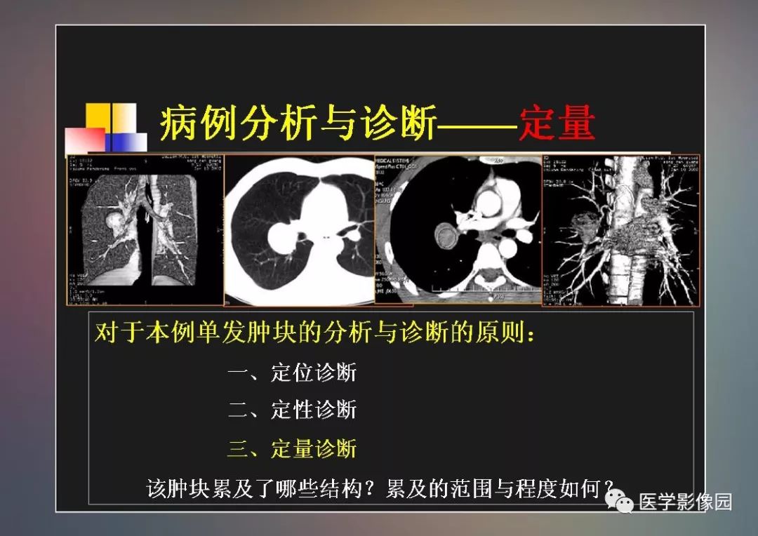 【PPT】右肺门区类圆形肿物的鉴别诊断—病例分析