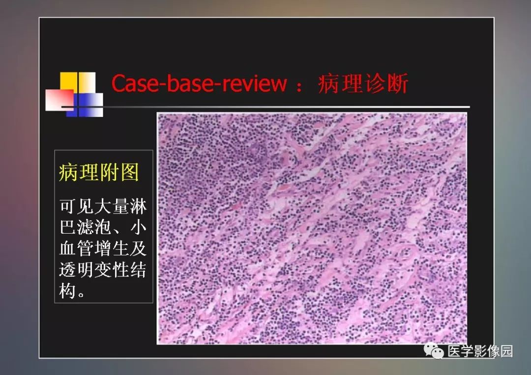 【PPT】右肺门区类圆形肿物的鉴别诊断—病例分析