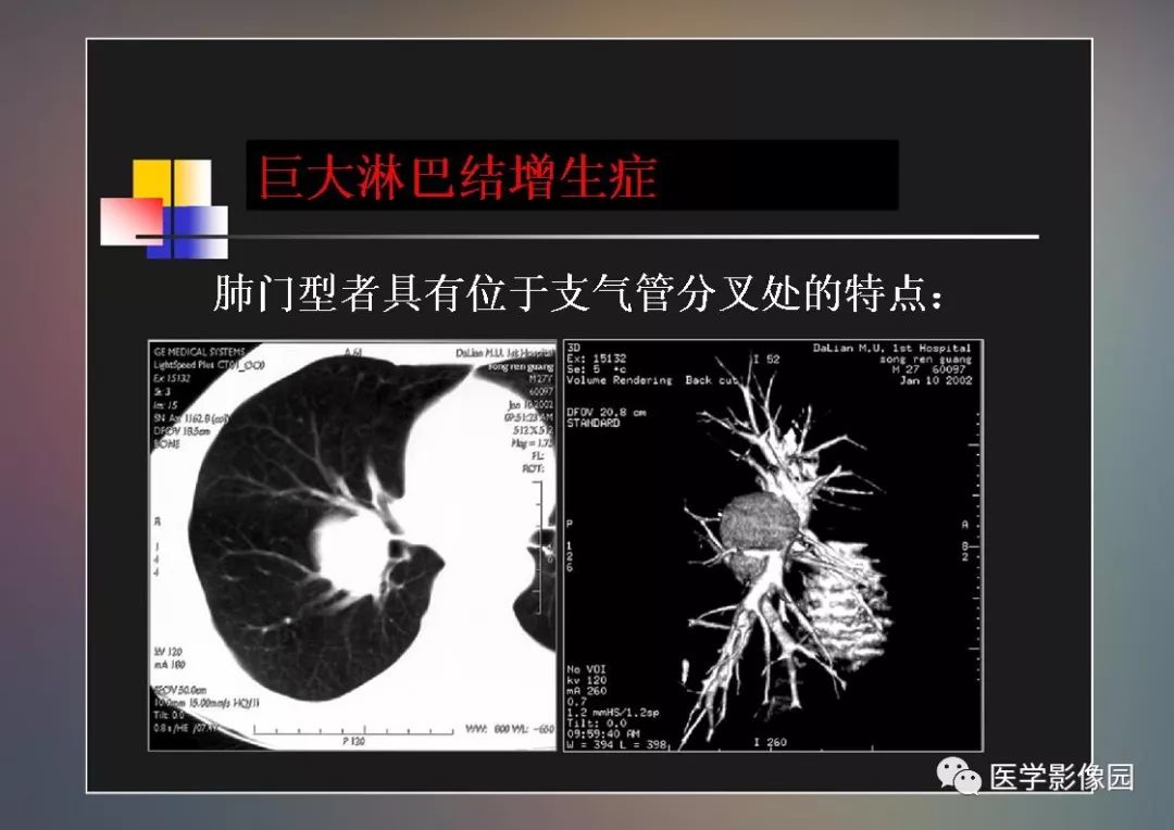 【PPT】右肺门区类圆形肿物的鉴别诊断—病例分析