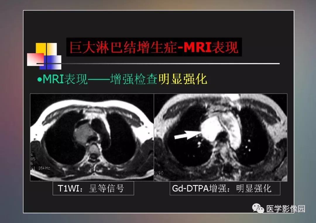 【PPT】右肺门区类圆形肿物的鉴别诊断—病例分析