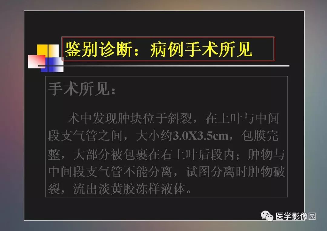 【PPT】右肺门区类圆形肿物的鉴别诊断—病例分析