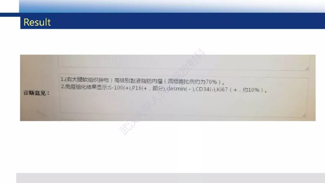 【PPT】含脂肪软组织肿瘤性病变影像诊断
