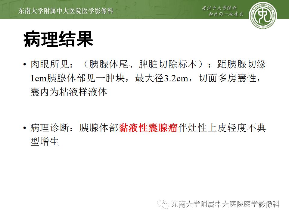 【病例】胰腺黏液性囊腺瘤1例CT影像表现