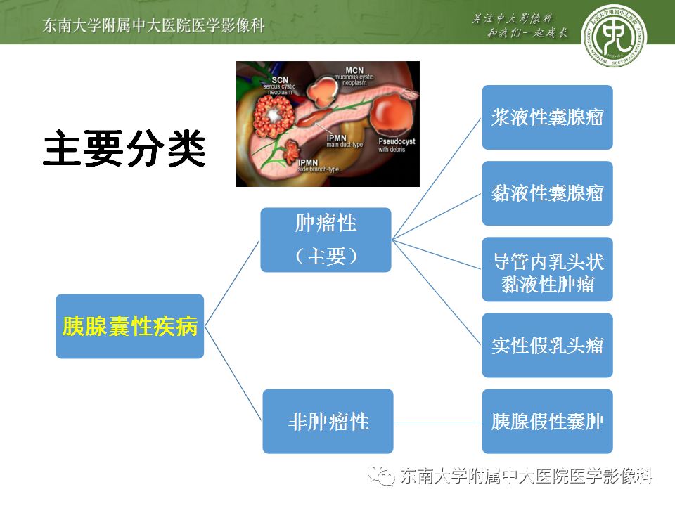 【病例】胰腺黏液性囊腺瘤1例CT影像表现
