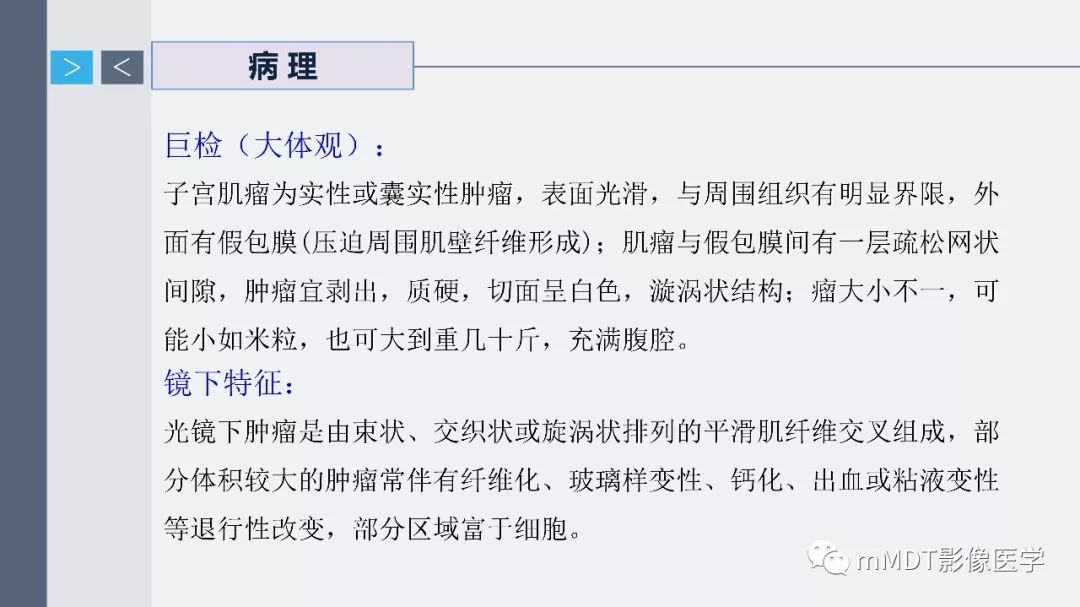 【PPT】子宫平滑肌瘤(子宫肌瘤)影像诊断