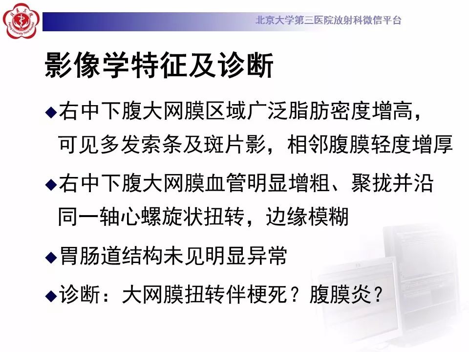 【病例】大网膜扭转1例CT影像诊断