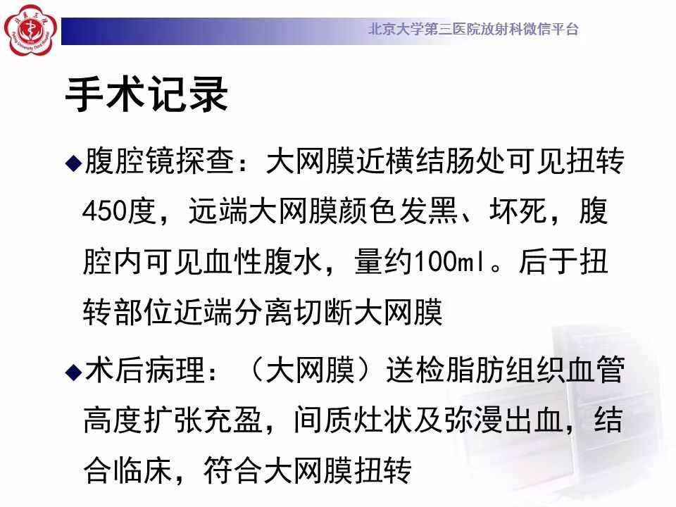 【病例】大网膜扭转1例CT影像诊断