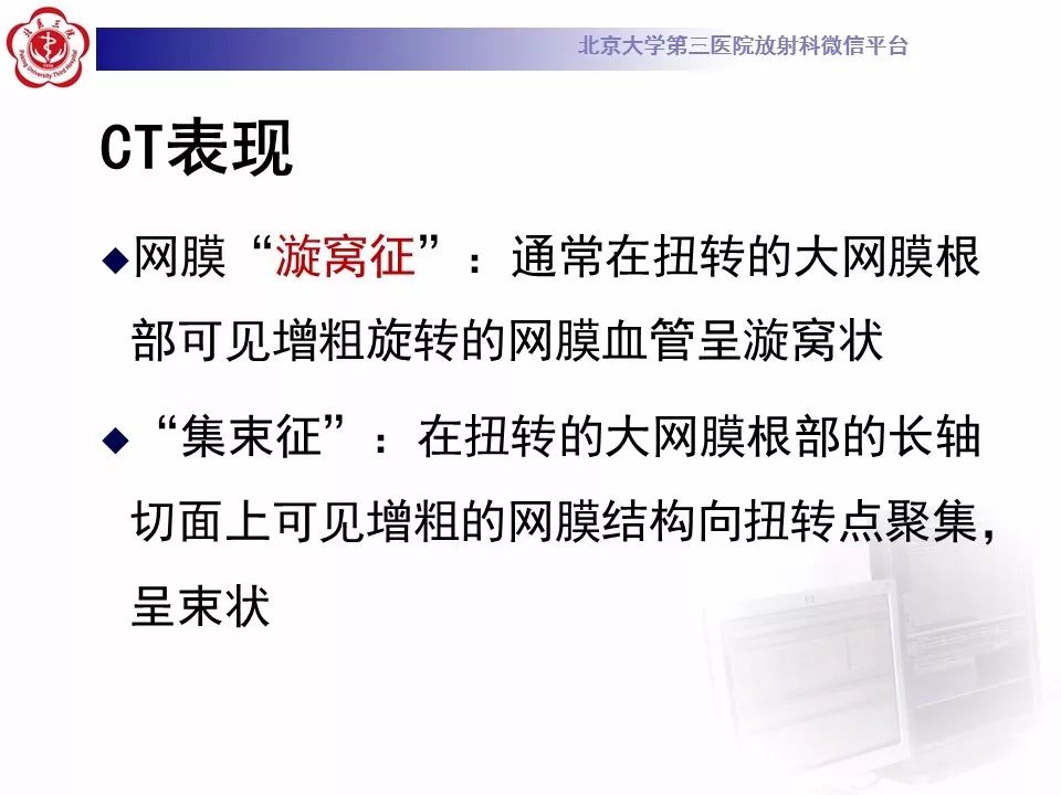 【病例】大网膜扭转1例CT影像诊断