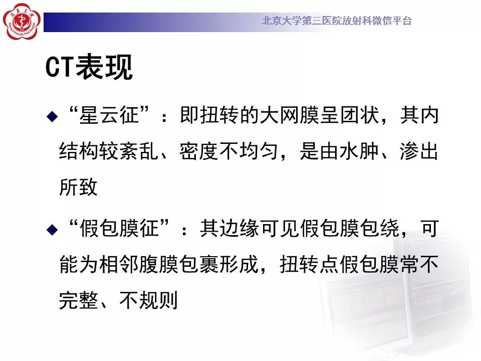 【病例】大网膜扭转1例CT影像诊断