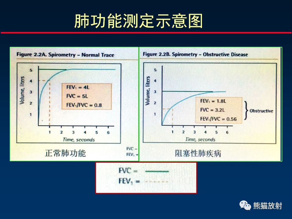 【PPT】放射科医生如何应对慢阻肺