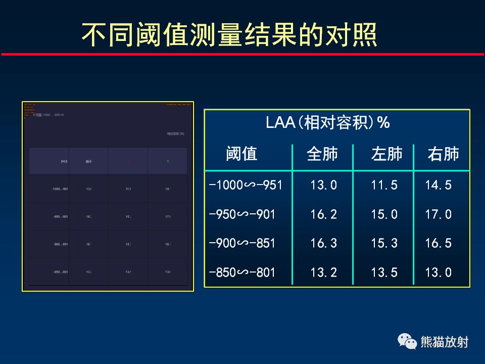 【PPT】放射科医生如何应对慢阻肺