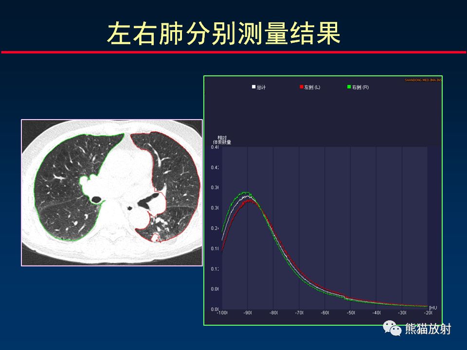 【PPT】放射科医生如何应对慢阻肺
