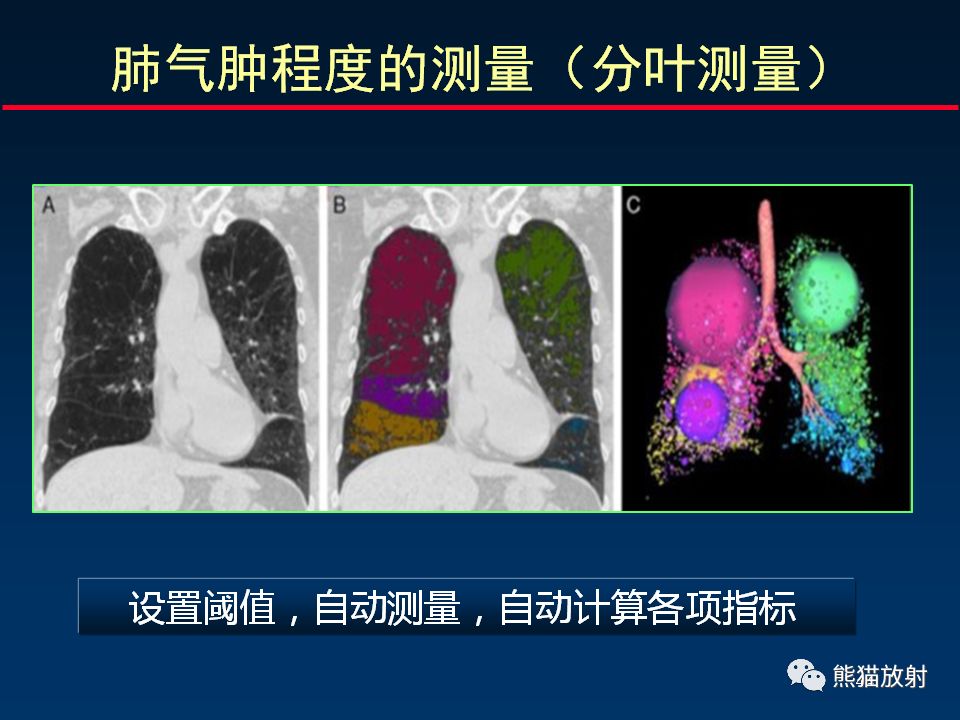 【PPT】放射科医生如何应对慢阻肺