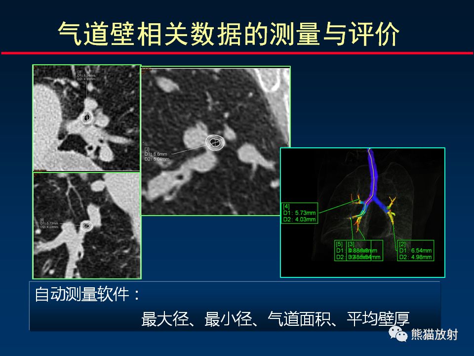 【PPT】放射科医生如何应对慢阻肺