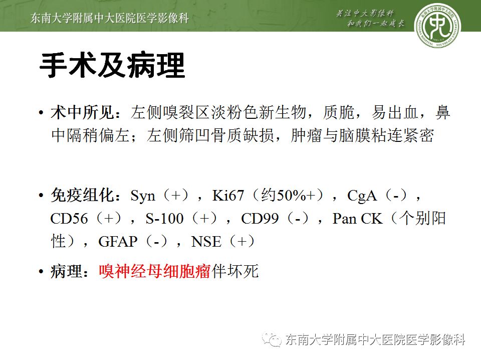 【病例】嗅神经母细胞瘤1例MR影像诊断