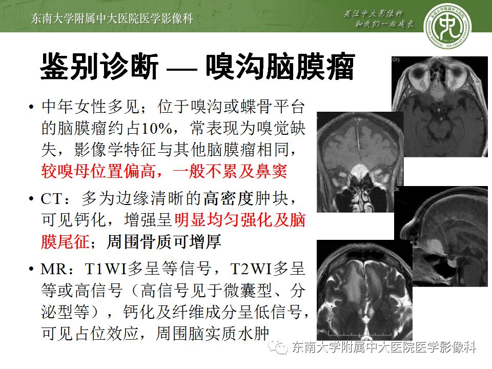 【病例】嗅神经母细胞瘤1例MR影像诊断