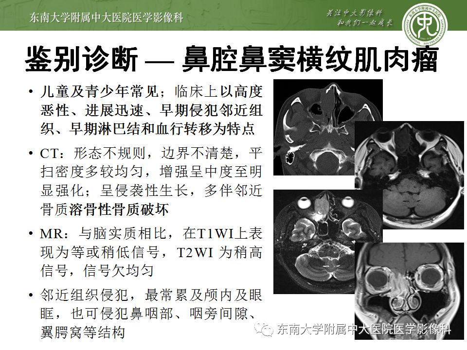 【病例】嗅神经母细胞瘤1例MR影像诊断
