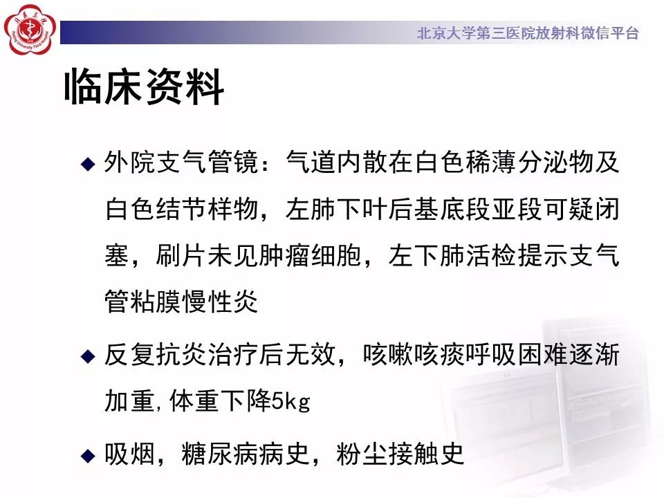 【病例】肺炎型肺癌1例CT影像表现