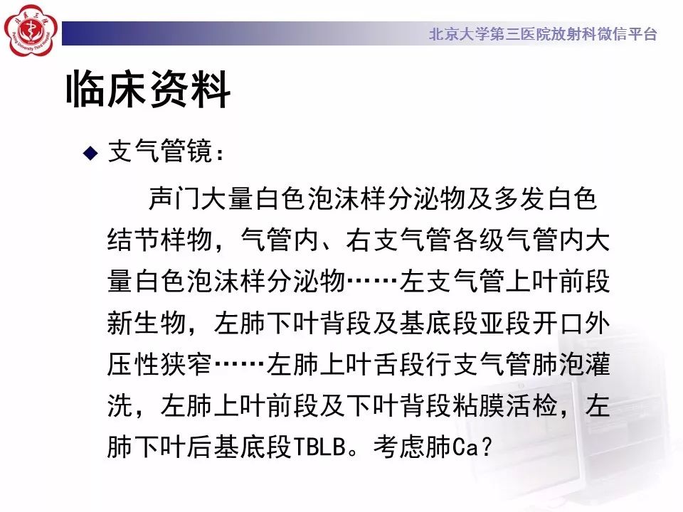 【病例】肺炎型肺癌1例CT影像表现