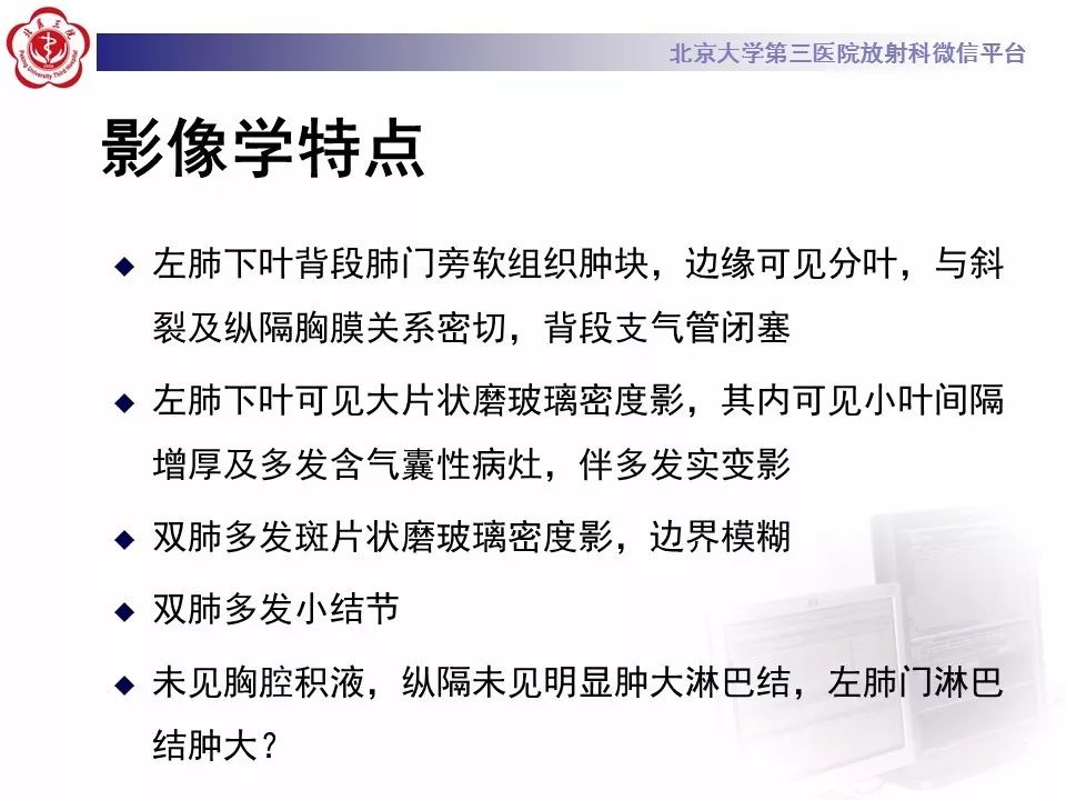 【病例】肺炎型肺癌1例CT影像表现