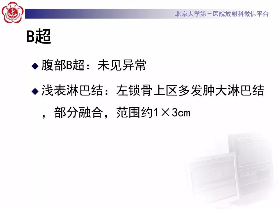 【病例】肺炎型肺癌1例CT影像表现