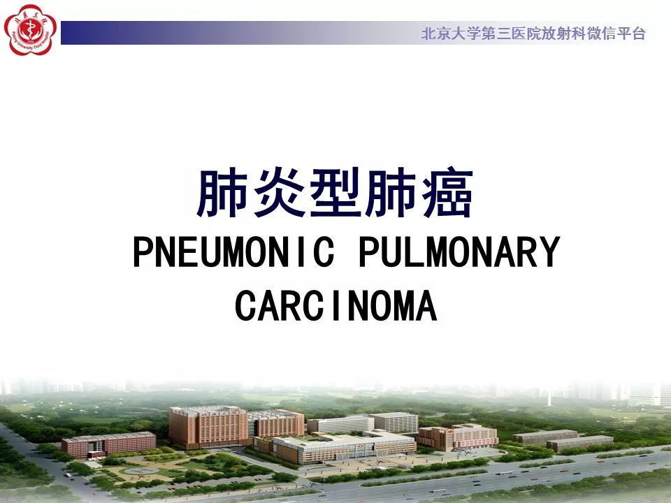 【病例】肺炎型肺癌1例CT影像表现