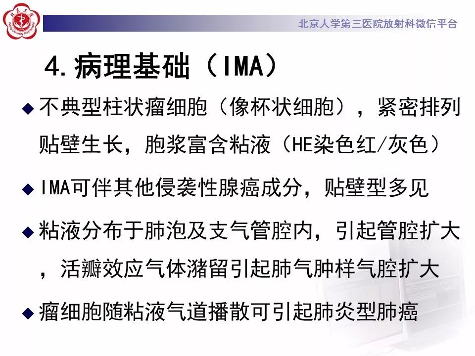 【病例】肺炎型肺癌1例CT影像表现