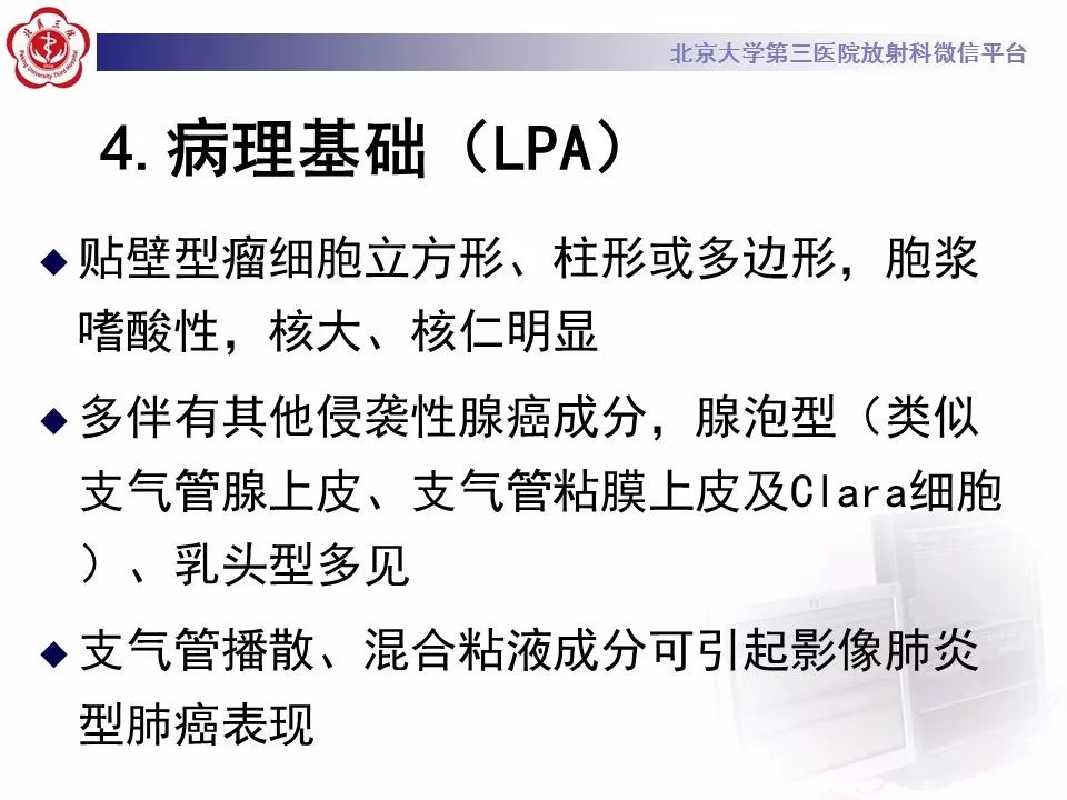 【病例】肺炎型肺癌1例CT影像表现
