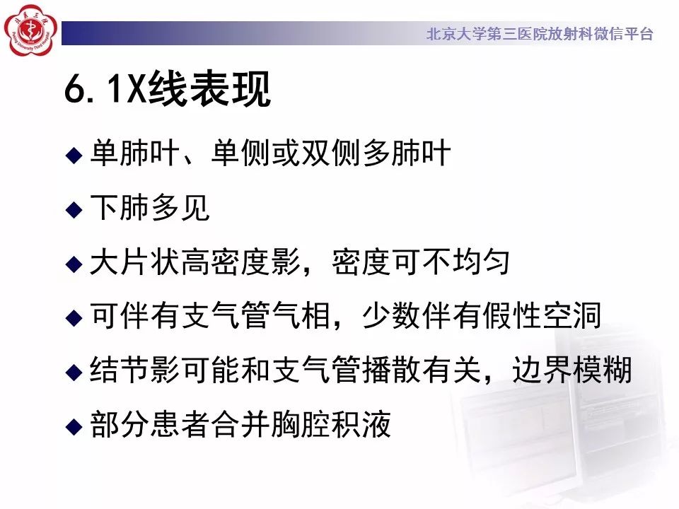 【病例】肺炎型肺癌1例CT影像表现