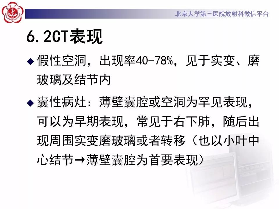 【病例】肺炎型肺癌1例CT影像表现