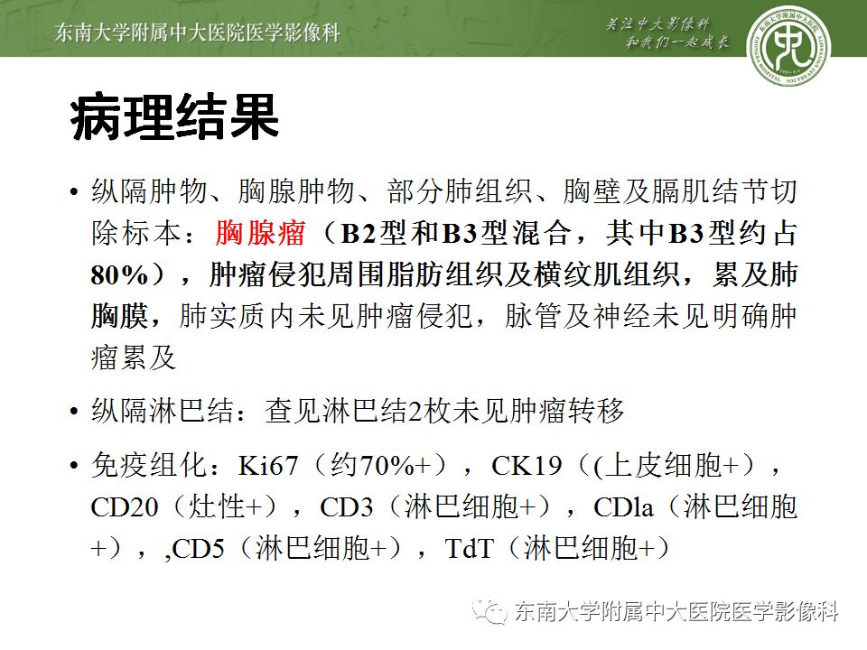 【病例】胸腺瘤1例CT影像诊断 【病例】胸腺瘤1例CT影像诊断
