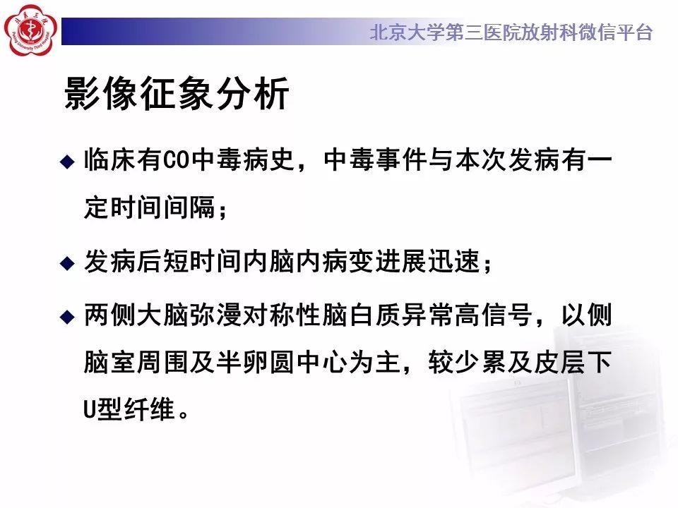 【病例】急性一氧化碳中毒迟发性脑病1例MR影像诊断