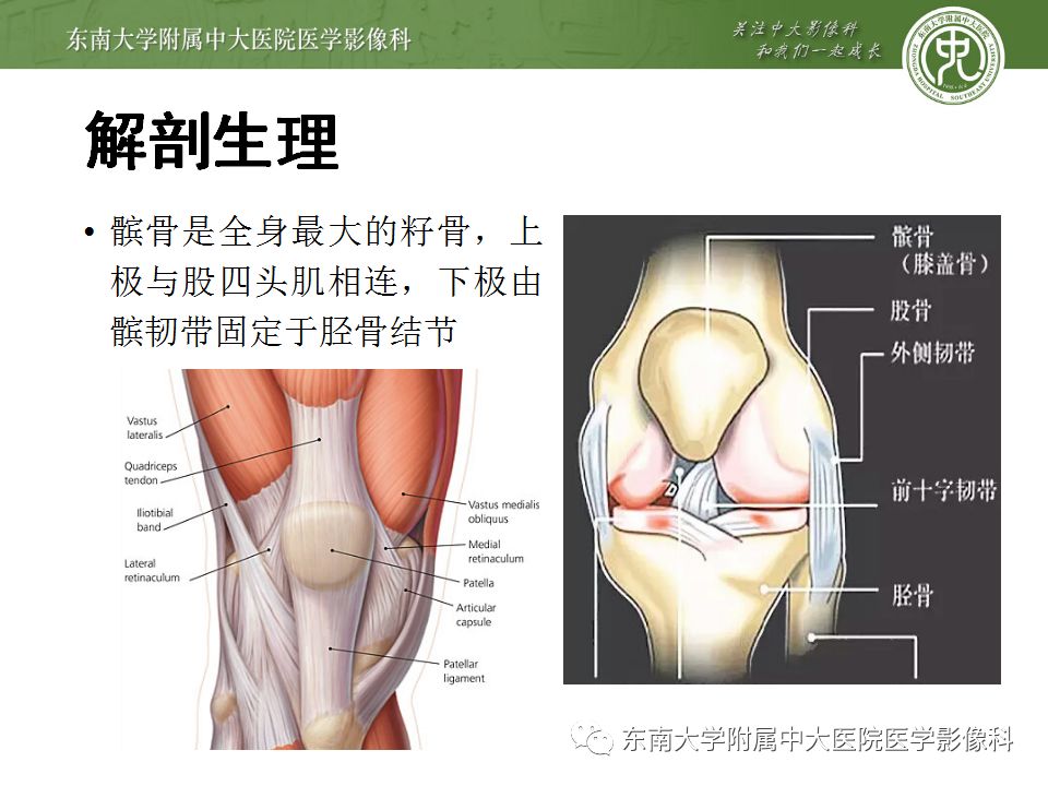 【病例】髌骨软化症1例MR影像诊断