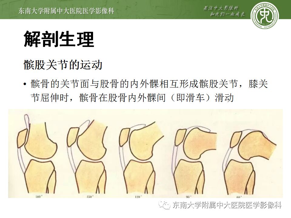 【病例】髌骨软化症1例MR影像诊断